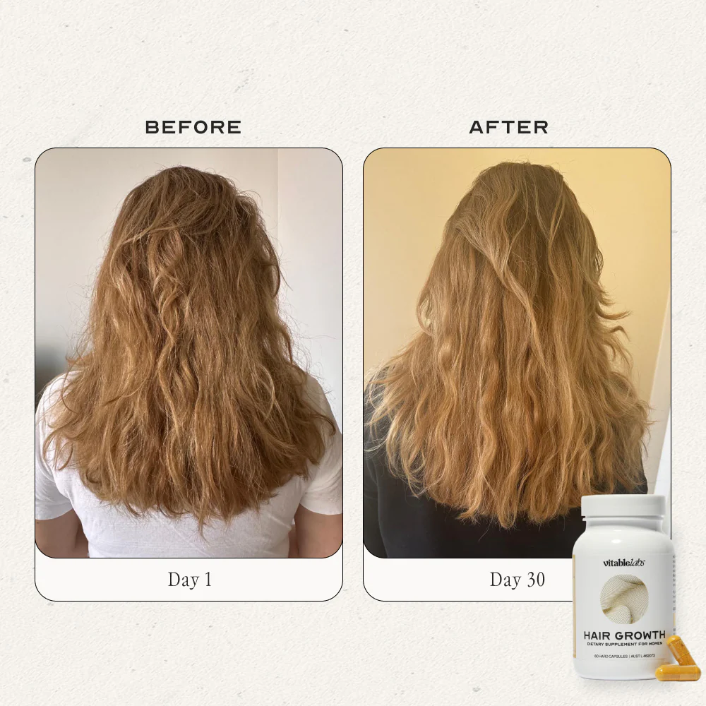 Hair Growth Capsules for Women - Image 12