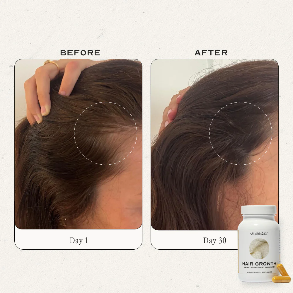 Hair Growth Capsules for Women - Image 13