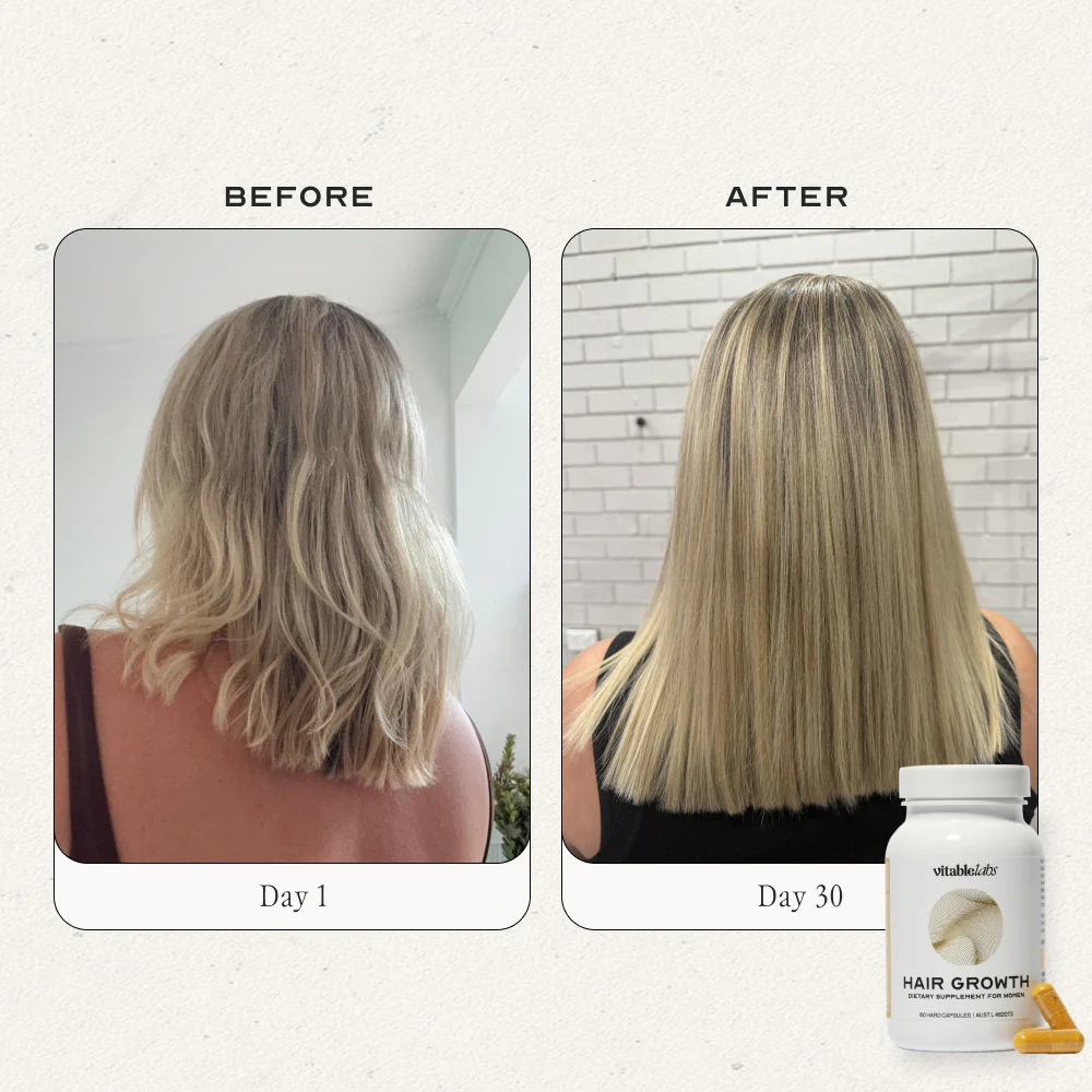 Hair Growth Capsules for Women - Image 4